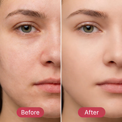 Wake Up To Radiant Skin With KOJIC ACID TURMERIC WRAPPING MASK - QUEEN SKIN